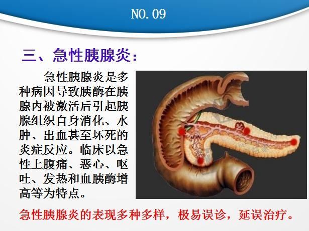 胰腺炎最好的抗生素药是什么_胰腺炎吃什么抗生素效果好_胰腺炎抗生素三联