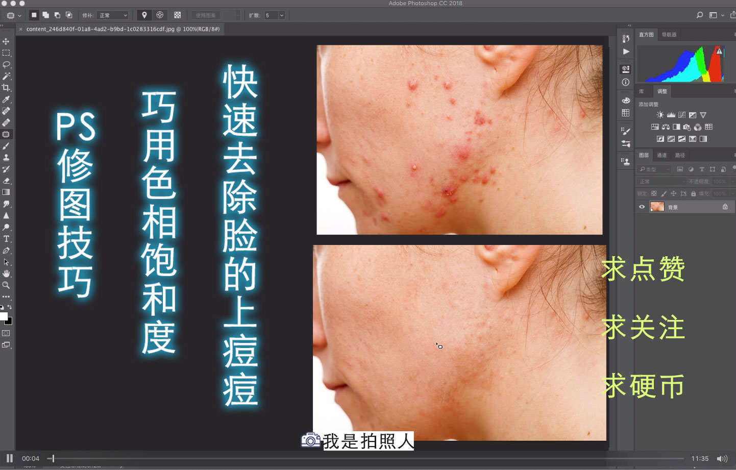 有痘痘的脸ps素材：修饰效果究竟如何？