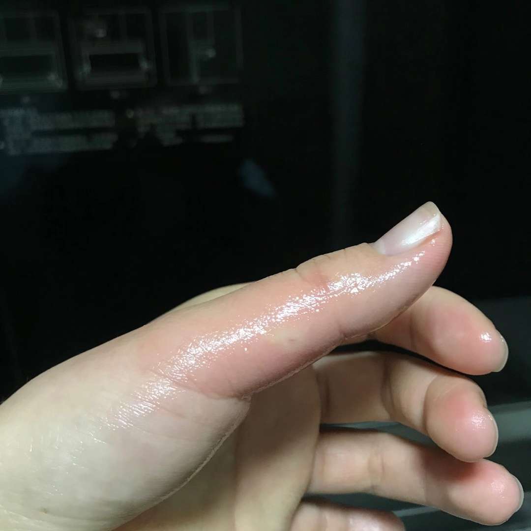 黄蜂蛰了怎么办-黄蜂蛰伤怎么办？教你6招应对，冷静远离蜂窝，